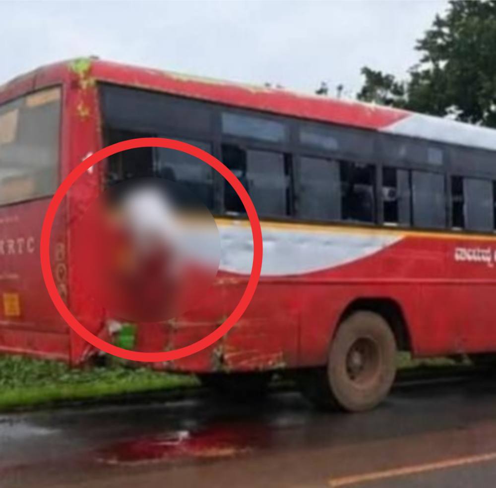 belgaum-news-horrific-accident-near-kundgol-hubbali-student-died-in-a-road-accident-near-kundgol-in-karnataka-hubli-karnataka-teen-decapitated-after-leaning-out-of-moving-bus-window-tipper-truck-hit-202607.jpg | @ कर्नाटक; धावत्या बसच्या खिडकीतून गुटखा थुंकताना शीर धडावेगळे; विद्यार्थी ठार | belgaum news | belgavkar बेळगावकर