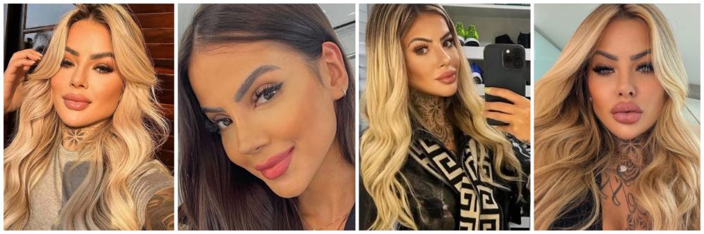 कॉस्मेटिक सर्जरी जीवावर बेतली; सोशल मीडिया इन्फ्लुएंसरचं निधन;