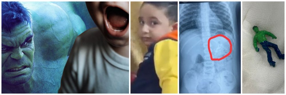 अरे बापरे... अवघ्या दीड वर्षांच्या मुलाने 'हल्क'ला गिळलं;