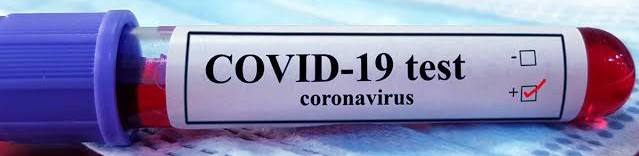 corona-large.jpg | H3N2 Virus च्या वाढत्या धोक्याच्या पार्श्वभूमीवर कोरोना संसर्गाच्या रुग्णातही वाढ; | belgaum news | belgavkar बेळगावकर