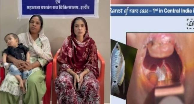 indore-baby-in-hospital-after-fish-jumps-into-throat-during-aquarium-cleaning-fish-jumps-into-1-year-old-boys-throat-during-aquarium-cleaning-202604.jpg | ...अन् 1 वर्षांच्या बाळाच्या घशात अडकला जिवंत मासा; | belgaum news | belgavkar बेळगावकर