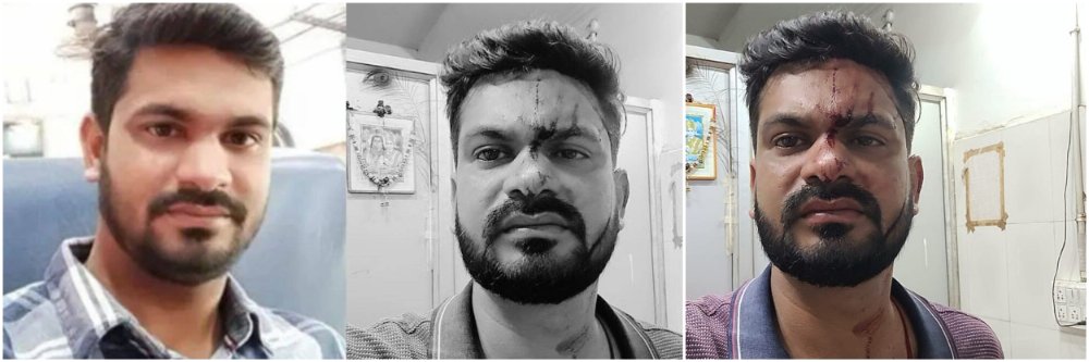 man-dies-in-balangir-kin-claims-wife-hit-him-on-head-with-mobile-phone-man-dies-after-wife-hits-him-with-mobile-phone-odisha-man-dies-after-wife-hits-him-with-mobile-phone-20260713.jpg | संतापलेल्या बायकोने डोक्यात फोन फेकून मारला, नवऱ्याने जीव गमावला; | belgaum news | belgavkar बेळगावकर