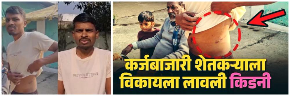 ₹ 1 लाखाचं कर्ज झालं ₹ 74 लाख; कर्ज फेडण्यासाठी शेतकऱ्यानं विकली किडनी;