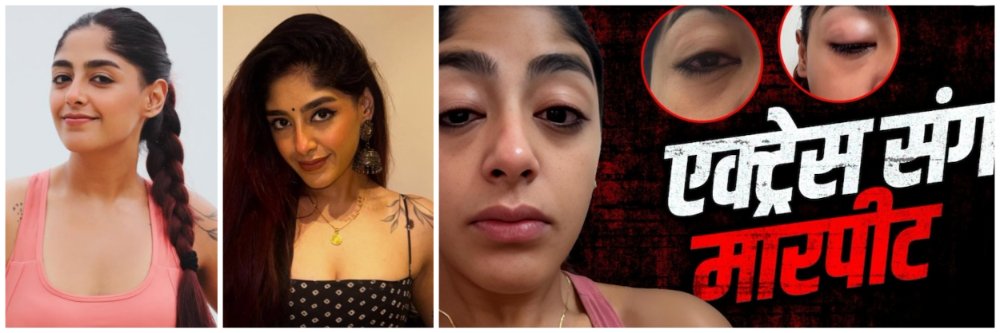 डोळे सुजले, दात तुटला; अभिनेत्रीवर क्लबमध्ये भयंकर हल्ला