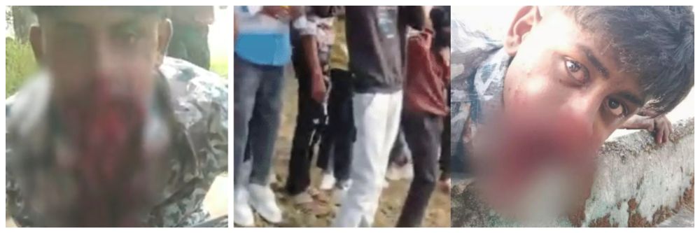 रिलसाठी काय पण? तोंडात सुतळी बॉम्ब ठेवून पेटवलं;